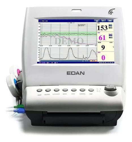 Mon. Fetal Edan F6 Express