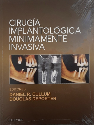 Cullum - Cirugía Implantológica Mínimamente Invasiva Nuevo