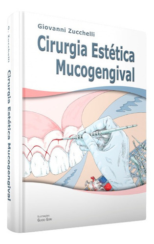 Cirurgia Estética Mucogengival - Giovanni Zucchelli