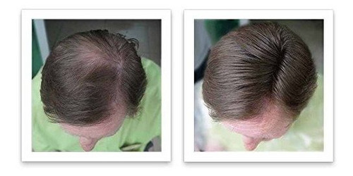 Corrector De Pérdida De Cabello Caboki - Marrón Oscuro