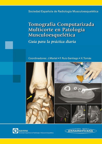 Serme:tc Multicorte Patol. Musculo Esque, De Serme Sociedad Española De Radiologia Mu. Editorial Médica Panamericana S.a., Tapa -1 En Español