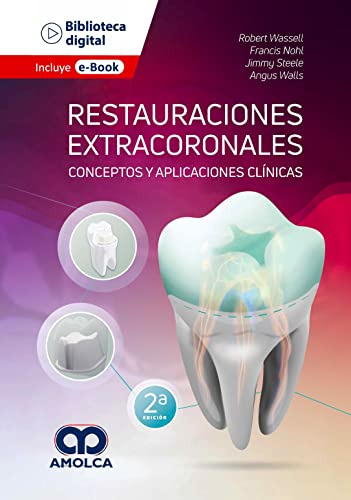 Libro Restauraciones Extracoronales. Conceptos Y Aplicacione