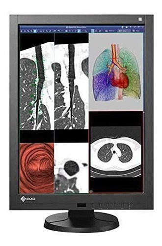 Renovado® Eizo Radiforce Rx240 2mp Color Led Medical Diagnos