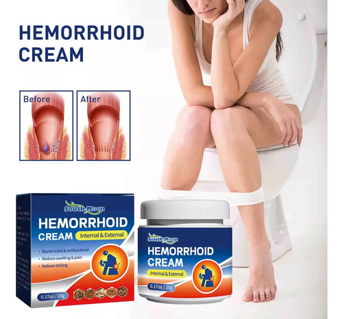 Hemorroides Mixtas Internas Y Externas Y Fisura Anal