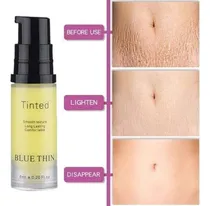 Comprar Tratamento De Estrias A Laser 3 Tipos De Estrias Corpo Com E