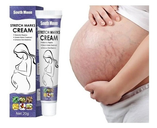  01 Creme Para Estrias E Celulite Stretch Marks Cream