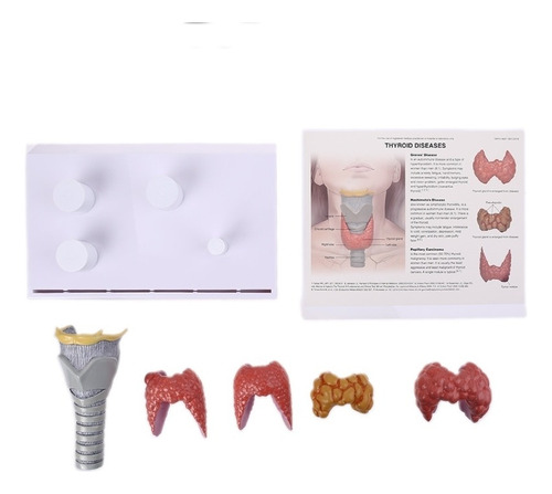 Anatomía De La Patología Del Modelo De La Glándula Tiroides