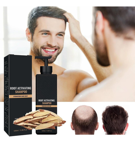 Champú Ticton S-par-ta_n Root Activator Para La Caída Del Ca