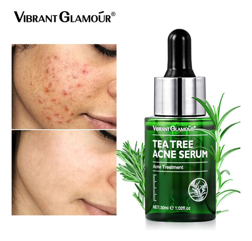 Tea Plantacne Essence Acné Manchas Reparador De Boca Cerrada