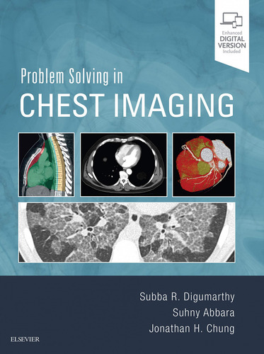 Problem Solving In Chest Imaging - Digumarthy;abbara;chun
