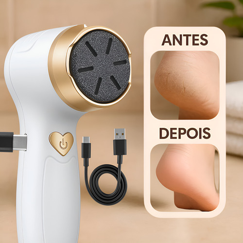 Motorzinho Para Lixar Calos Rachaduras Ideal Para Pedicures