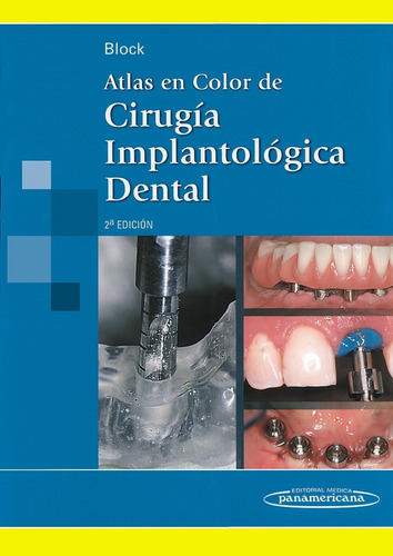 Atlas De Cirugía Implantología Dental