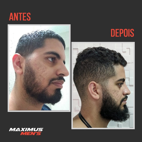 Imagem 4 de 10 de Maximus Beard Para Crescimento De Barba - Tratamento 30 Dias