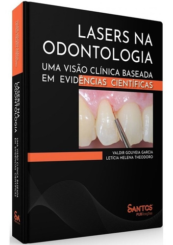 Livro Lasers Na Odontologia Uma Visão Clínica