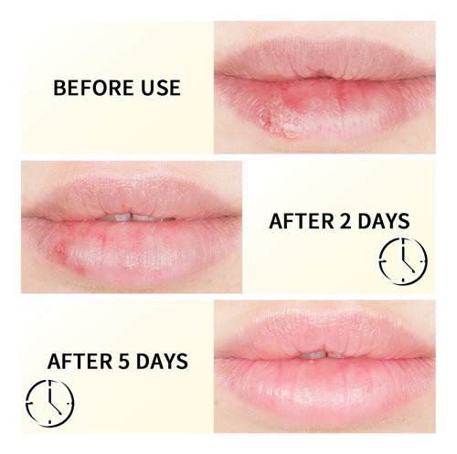 La Máscara De Brillo De Labios Hidrata Y Humecta En Invierno