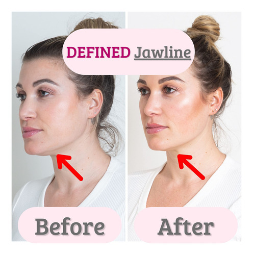 Aparato De Ejercicio Facial Blafit Bella Lip Appliance Laven