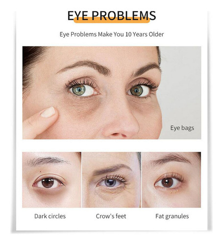 Inchaço Nos Olhos, Olhos Inchados Com Cafeína, Creme Reparad