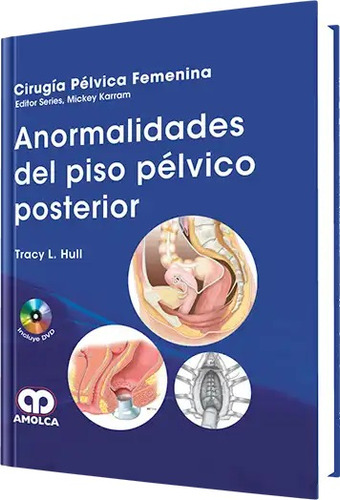 Anormalidades Del Piso Pélvico Posterior