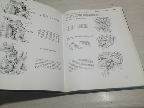 Libro. Atlas De Técnica Quirúrgica. Grewe. Kremer (Usado)