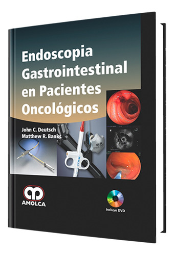 Endoscopia Gastrointestinal En Pacientes Oncológicos