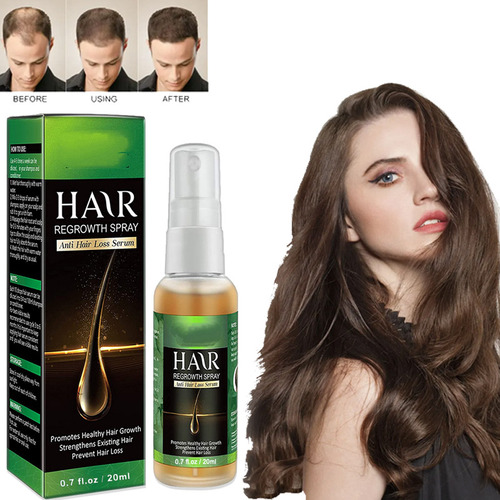 Spray Nutritivo Para El Cabello, Solución Anticaída Para El