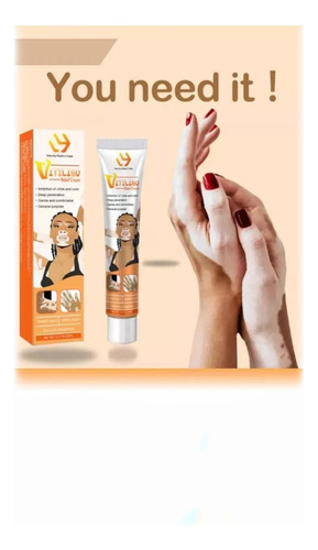 Crema Tratamiento Profesional Para Eliminar El Vitiligo Original