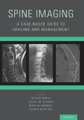 Libro Spine Imaging : A Case-based Guide To Imaging And M...