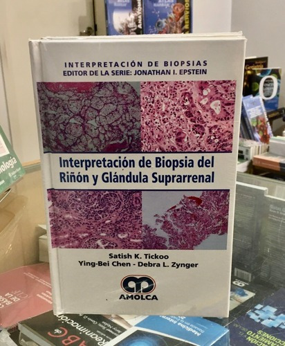 Interpretación De Biopsia Del Riñón Y Glándula Supra, De Satish K. Tickoo. Editorial Amolca En Español