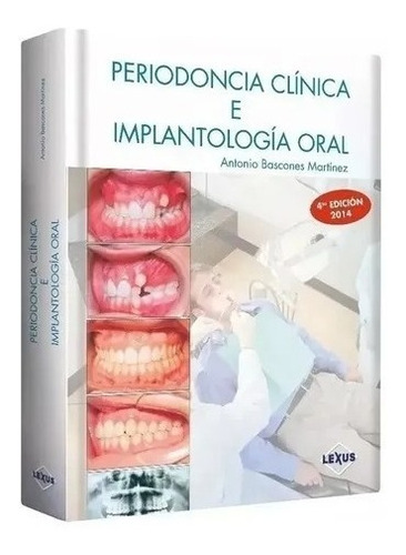 Odontología Priodontologia Clínica E Implantologia 