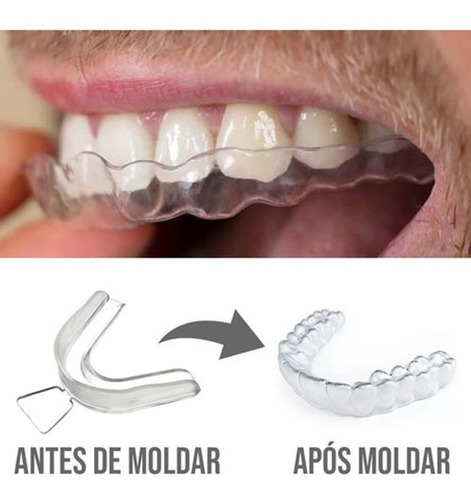 Imagem 3 de 7 de 2 Placa Anti Bruxismo Ranger Dentes Protetor Bucal Moldável