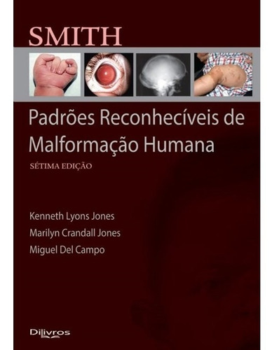 Livro: Smith Padrões Reconhecíveis De Malformação Humana