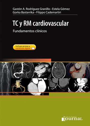 Tc Y Rm Cardiovascular  Rodrguez Granillo - Aauytzz