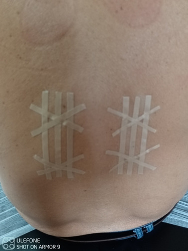 Imagem 5 de 5 de Acupuntura E Massagem Em Domicílio, Mande Mensagem No Whats.