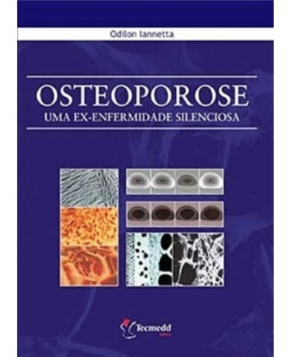 Osteoporose - Uma Ex-enfermidade Silenciosa - Lannetta, De Lannetta, Odilon. Editora Tecmedd, Capa Mole Em Português