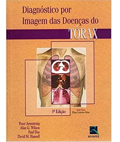 Diagnóstico Por Imagem Das Doenças Do Tórax