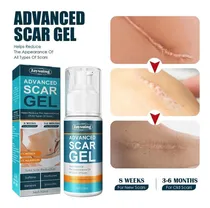 Comprar Gel De Cicatrizes Avançado Y Para Cicatrizes Ch4y E Estrias
