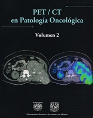 Pet/ct En Patología Oncológica, de Paulina Bezaury Rivas (Editora invitada). Serie 6070229725, vol. 1. Editorial MEXICO-SILU, tapa blanda, edición 2012 en español, 2012