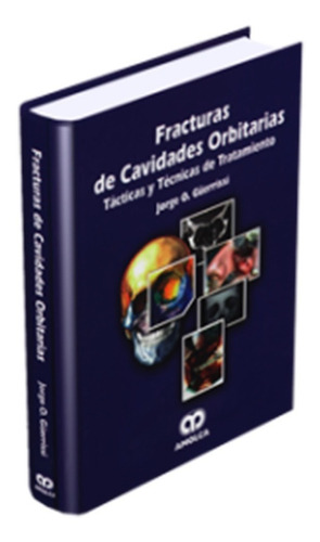 Fracturas De Cavidades Orbitarias. Tácticas Y Técnicas.