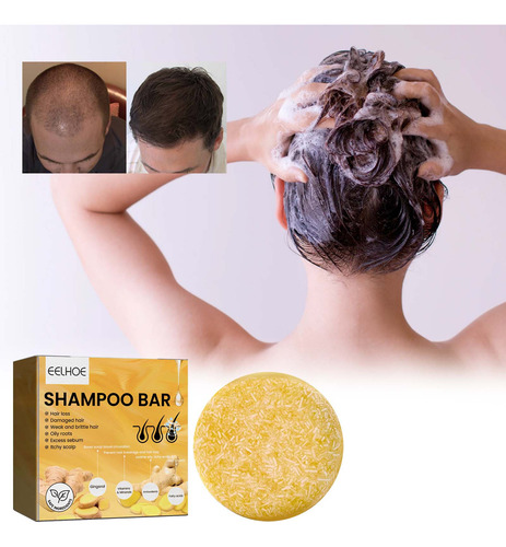 Champú E Para Mantenerlo No Grasoso, No Seco Y Sin Picazón 0