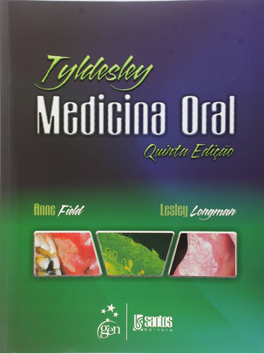 Medicina Oral de Tyldesley´s, de Longman, Anne Field E Lesley. Livraria Santos Editora Comércio e Importação Ltda., capa mole em português, 2013