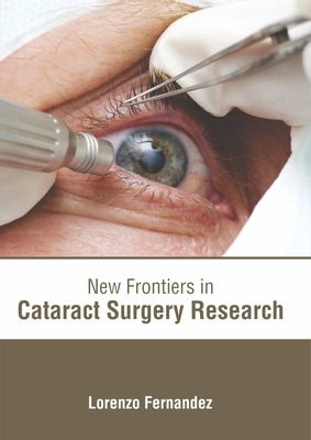 Libro New Frontiers In Cataract Surgery Research - Fernan...