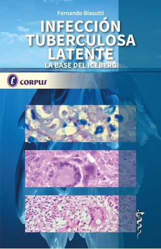 Infeccion Tuberculosa Latente Corpus Biasutti