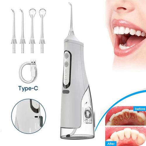 Irrigador Oral Recargable Usb Agua Flosser Portátil