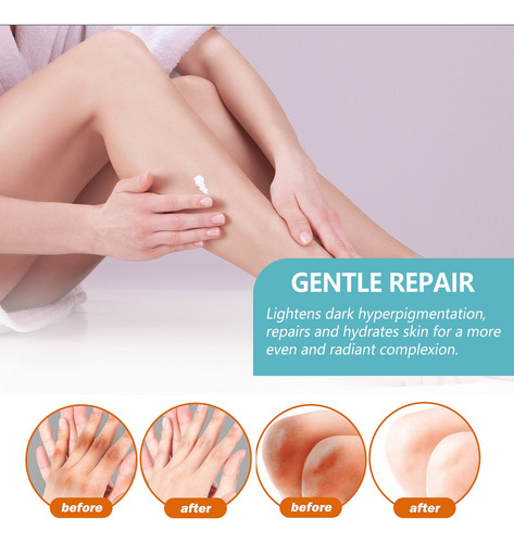 4×fixderma Nigrifix Crema Para Acantosis Nigricans Fbg E