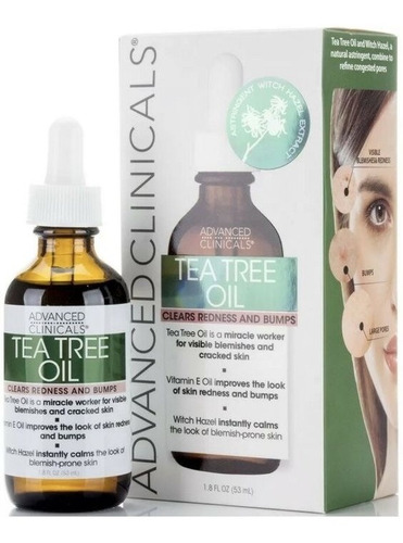 Tea Tree Oil Aceite Arbol De Te Control Espinillas Poros 