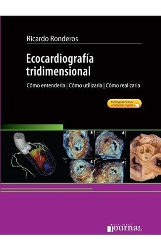 Ronderos Ecocardiografia Tridimensional 1ed/2016 Nuevo Envío