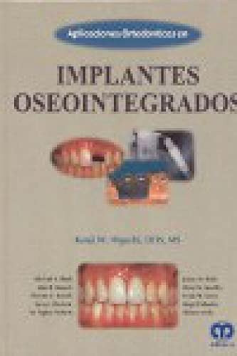 Libro Aplicaciones Ortodónticas En Implantes Oseosintegrados
