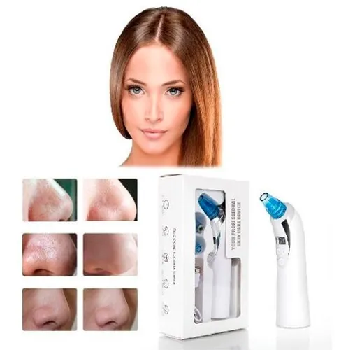 comprar Maquina Removedora O Removedor De Puntos Negros Acne Limpiez