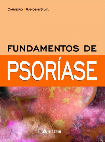 Fundamentos de Psoríase, de Carneiro, Sueli. Editora Atheneu Ltda, capa dura em português, 2017