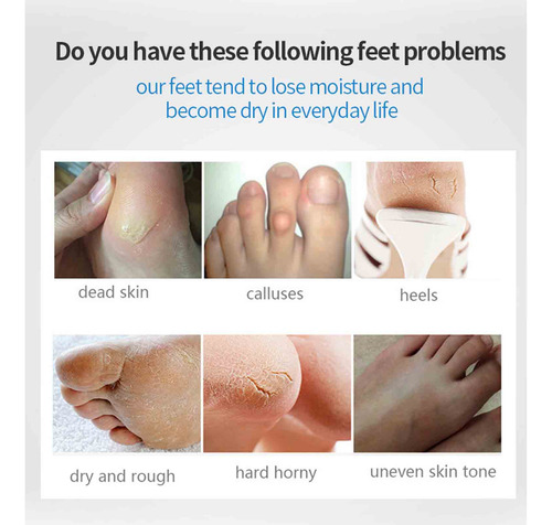 Foot Peel Mask Skin Calluses Repairing Exfoliant 10ml Remove